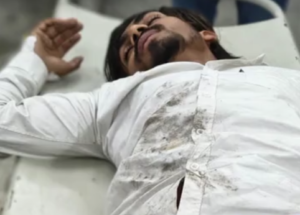 करनाल में पुलिस और बदमाशों के बीच मुठभेड़, 2 बदमाश घायल गिरफ्तार