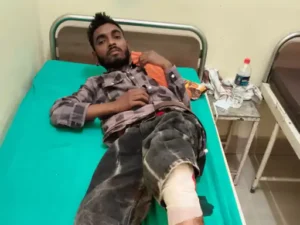 घायल बदमाश रजत को अस्पताल में दाखिल।